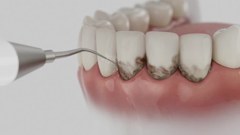Reliable Dental contractor in New California, OH by Dentist Open Now